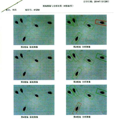 H酸价格走势最新分析